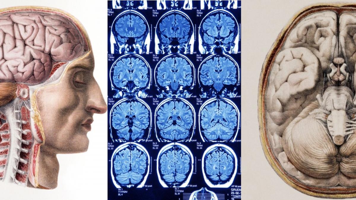 montage of brain images