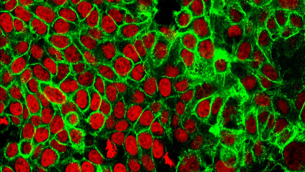 Microscopy image of human colon cancer cells